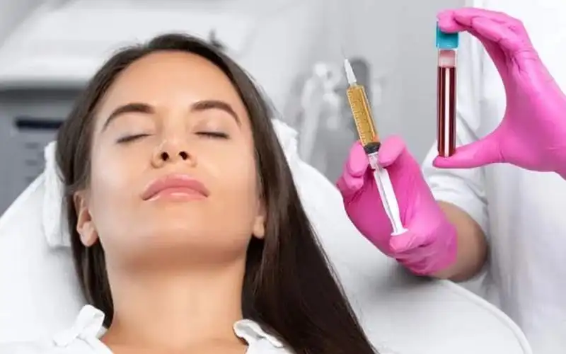 PRP چیست؟ مزایا، مراحل و مراقبت‌های بعد از پی آر پی