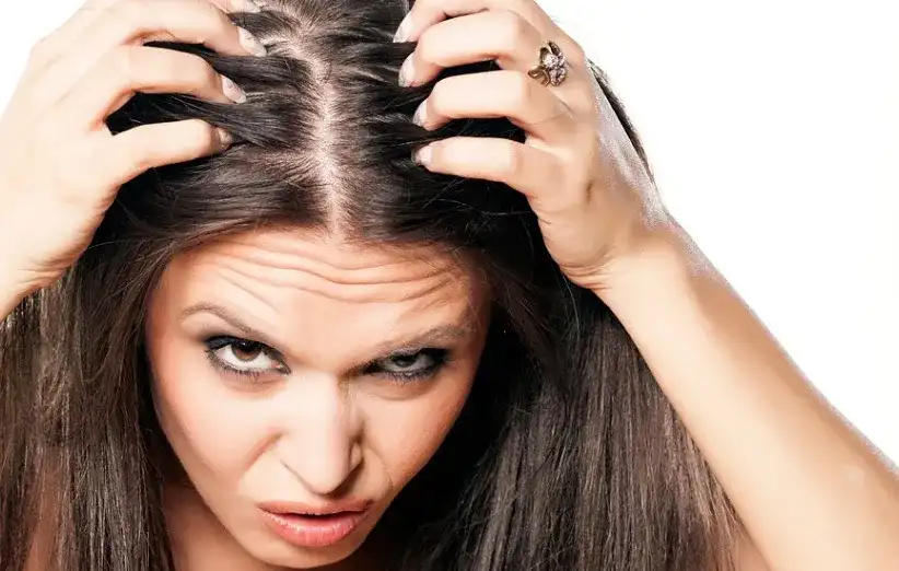 خارش سر چیست؟ علت ها، درمان خانگی و کلینیکی | متخصص پوست و مو
