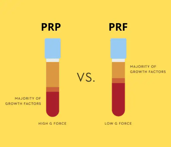 تفاوت PRP و PRF چیست؟ | مقایسه کاربرد، مزایا و تفاوت پلاسمای غنی از پلاکت
